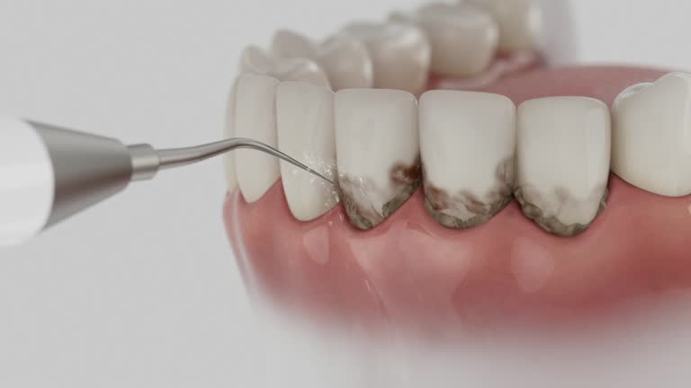 Reliable Emergency Dentist contractor in Noank, CT by Smile Center Dentistry